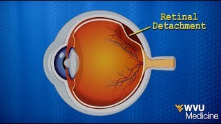 Anatomy  Vision Part 1  Retina Photoreceptors Bipolar Cells amp Ganglion Cells [upl. by Ursuline]