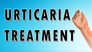 Urticaria Symptoms Treatment and Causes [upl. by Bigg448]