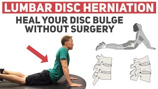 Will a Herniated Disc Heal on Its Own SURPRISING ANSWER [upl. by Stagg]