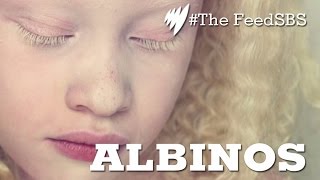 Albinos In Brazil [upl. by Ainaj]