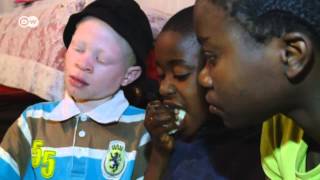 Kenya  Albinos Face Deadly Superstition  Global 3000 [upl. by Eneluqcaj]