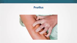 Pruritus  Dermatology  EduRx [upl. by Sllew]