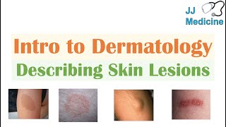 Introduction to Dermatology  The Basics  Describing Skin Lesions Primary amp Secondary Morphology [upl. by Xonnel]