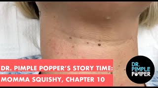 Dr Pimple Poppers Weekly Story Time Momma Squishy Chapter 10 [upl. by Smukler]