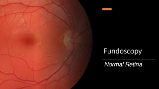 Retina  An Introduction  Part 1 [upl. by Rachel]