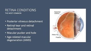 Torn Retina Cryopexy [upl. by Neetsirhc657]