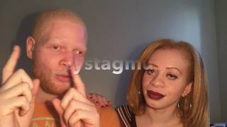 Albinism amp Nystagmus [upl. by Cinimmod254]