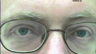 Nystagmus eye movement recording 1 [upl. by Berfield242]