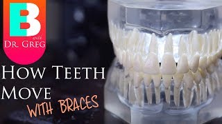 BRACES EXPLAINED How Teeth Move  Braces Work [upl. by Netsrik421]