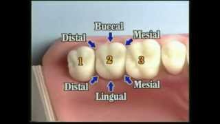 V109 Patient Records Management amp Dental Charting [upl. by Hillell]