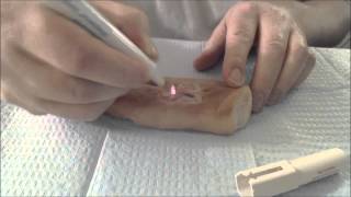 How to Control Bleeding With a Battery Cautery Unit [upl. by Kristos]