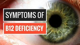 5 Signs and Symptoms of Vitamin B12 Deficiency [upl. by Connors]