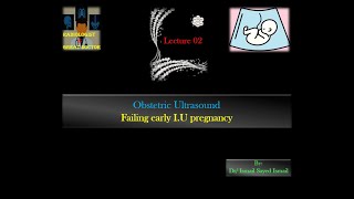 Obstetric Ultrasound Lecture 02 Failing early IU pregnancy [upl. by Susejedesoj]