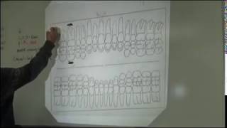 DATV Periodontal Charting [upl. by Riamu736]