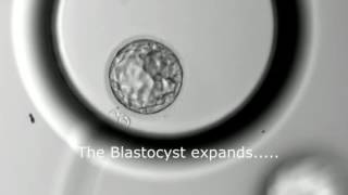 Blastocyst Development  Day 3 to Day 5 MUST SEE [upl. by Ylicec]