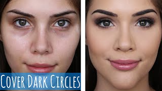 TREATING DARK CIRCLES amp PUFFY UNDEREYES  Causes amp Treatments An Estheticians Guide [upl. by Norry846]