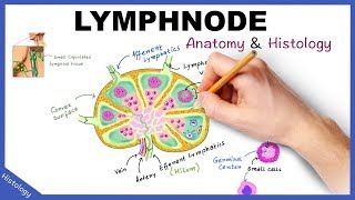 Manual Lymph Drainage MLD demonstrated on lymphedema patient [upl. by Ardnued702]