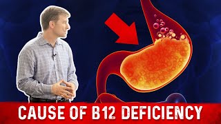 Vitamin B12 Deficiency The most common Cause – Dr Berg [upl. by Atteynod]