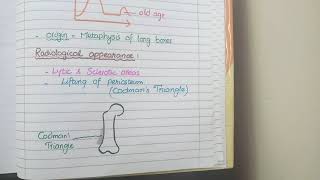 Osteosarcoma Pathology [upl. by Sidonie]