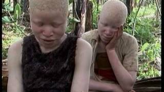 Deadly Hunt Albinos in Tanzania [upl. by Williamson]